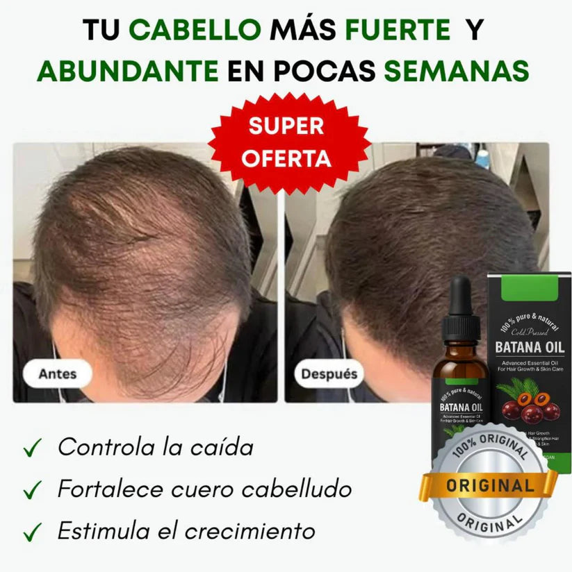Aceite Batana™ 100% Puro con Romero y Maca Nutritivo Estimula el Crecimiento Capilar y Restaura el Cabello Dañado
