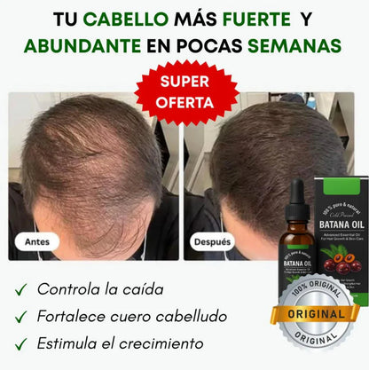 Aceite Batana™ 100% Puro con Romero y Maca Nutritivo Estimula el Crecimiento Capilar y Restaura el Cabello Dañado